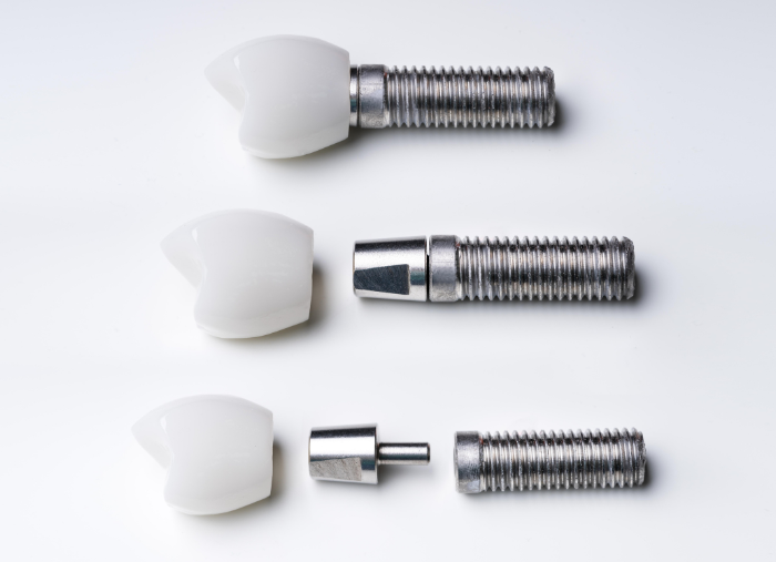 Componente implant dentar: implant, bont și coroană 4 componente ale implantului dentar
