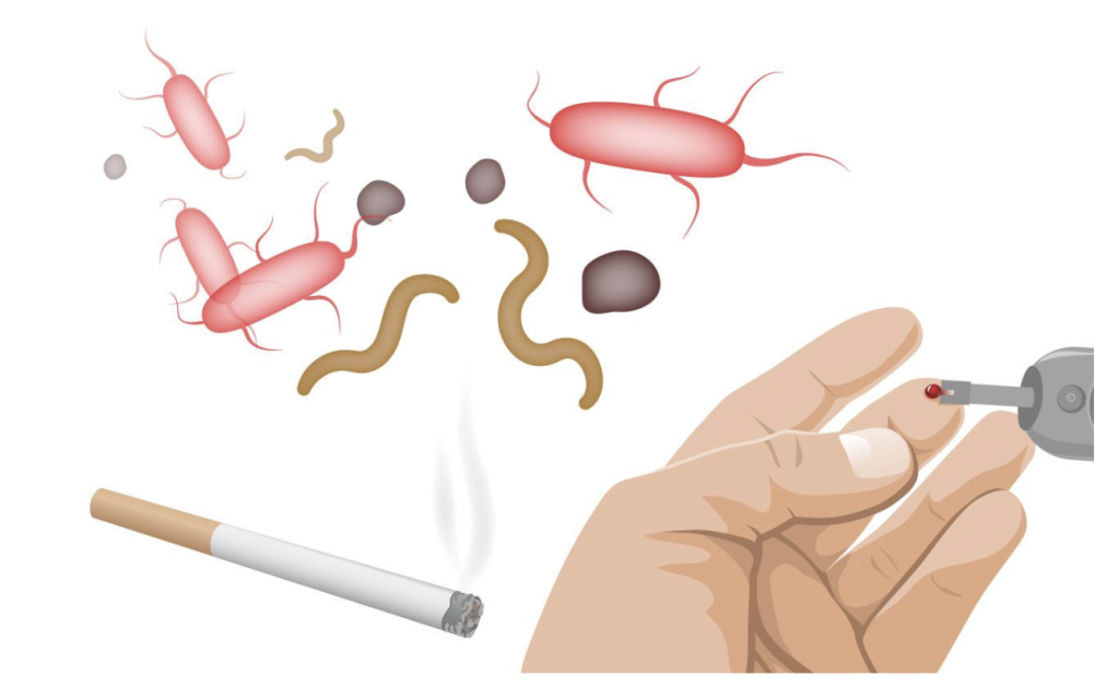 Parodontita: Ce trebuie să știi despre această afecțiune inflamatorie 4 factori externi parodontoza