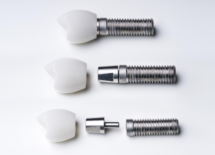 Componente implant dentar: implant, bont și coroană