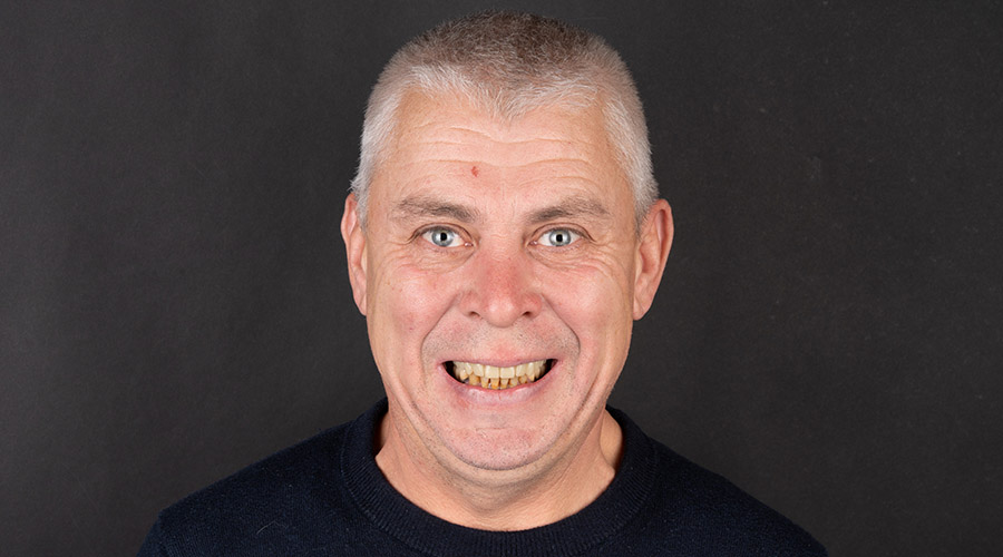 All-on-4 — înainte