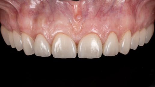 Protetică dentară