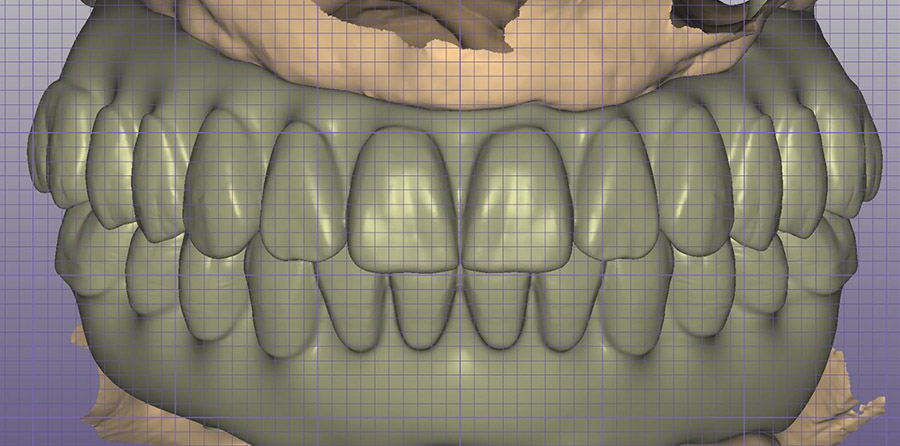 CAD